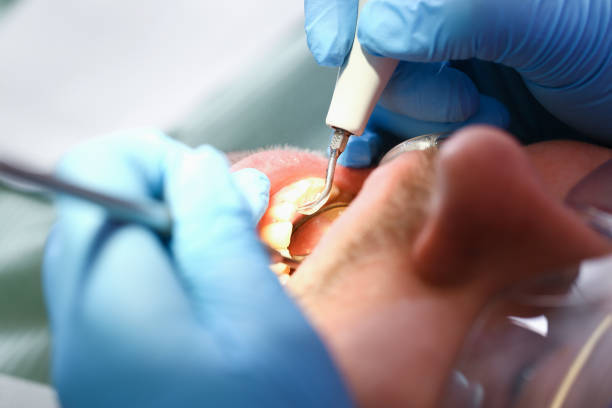 Best Holiday Emergency Dentist in Chatmoss, VA