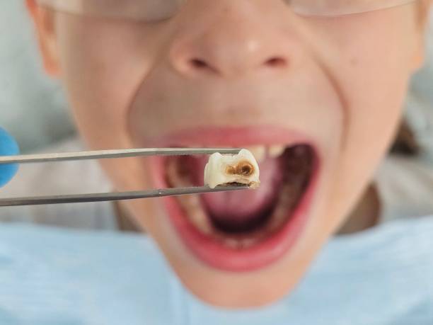 Best Orthodontic Emergency Dentist in Chatmoss, VA